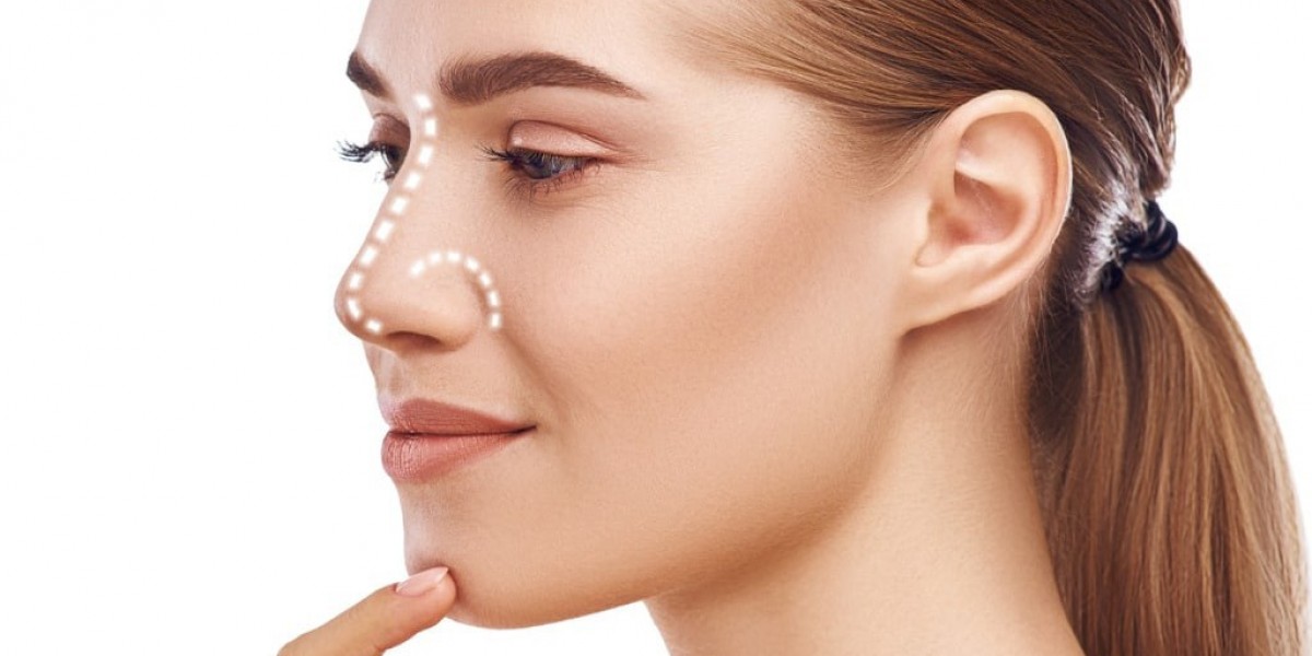 What Makes Dynamic Clinic PK the Best Choice for Rhinoplasty in Islamabad?